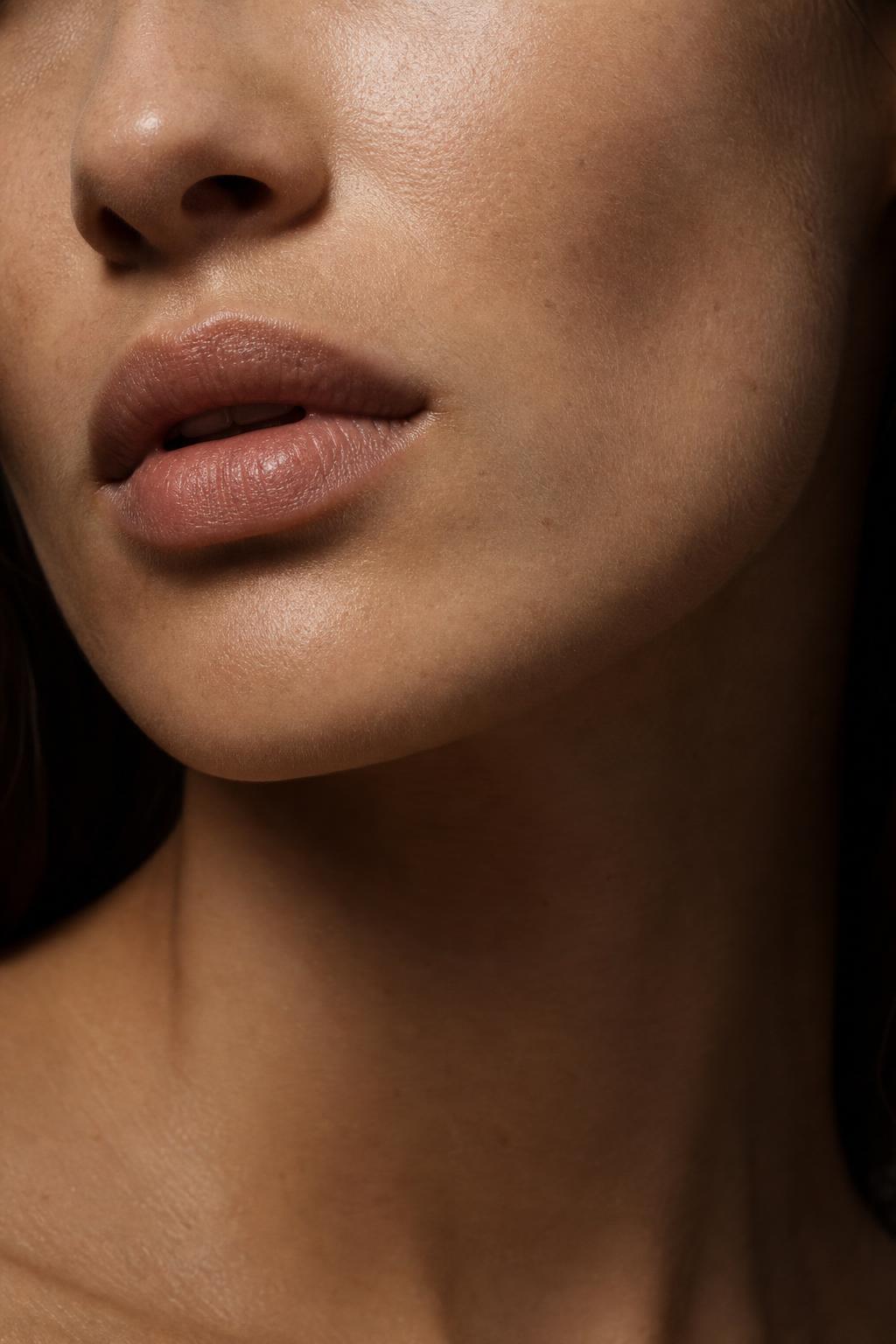Dermal Filler