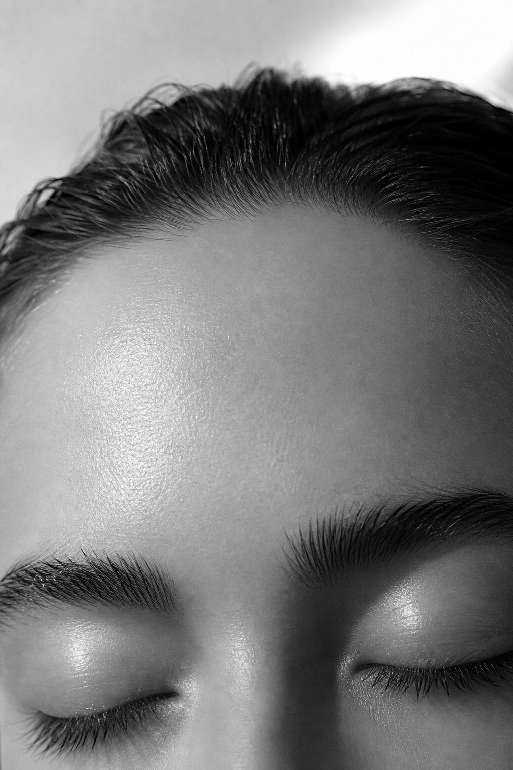 Skin Peels